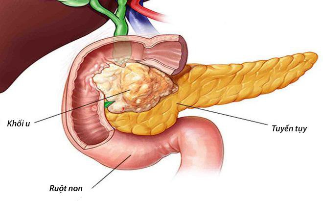 Lựa chọn bác sĩ và bệnh viện để mổ vách ngăn mũi